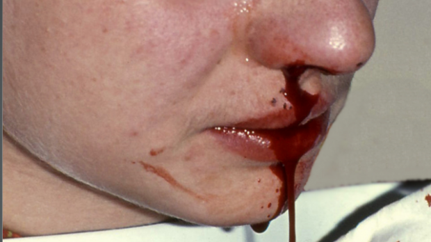 Ergebnisreichst otbeliwajuschtschi die Creme von pigment-
